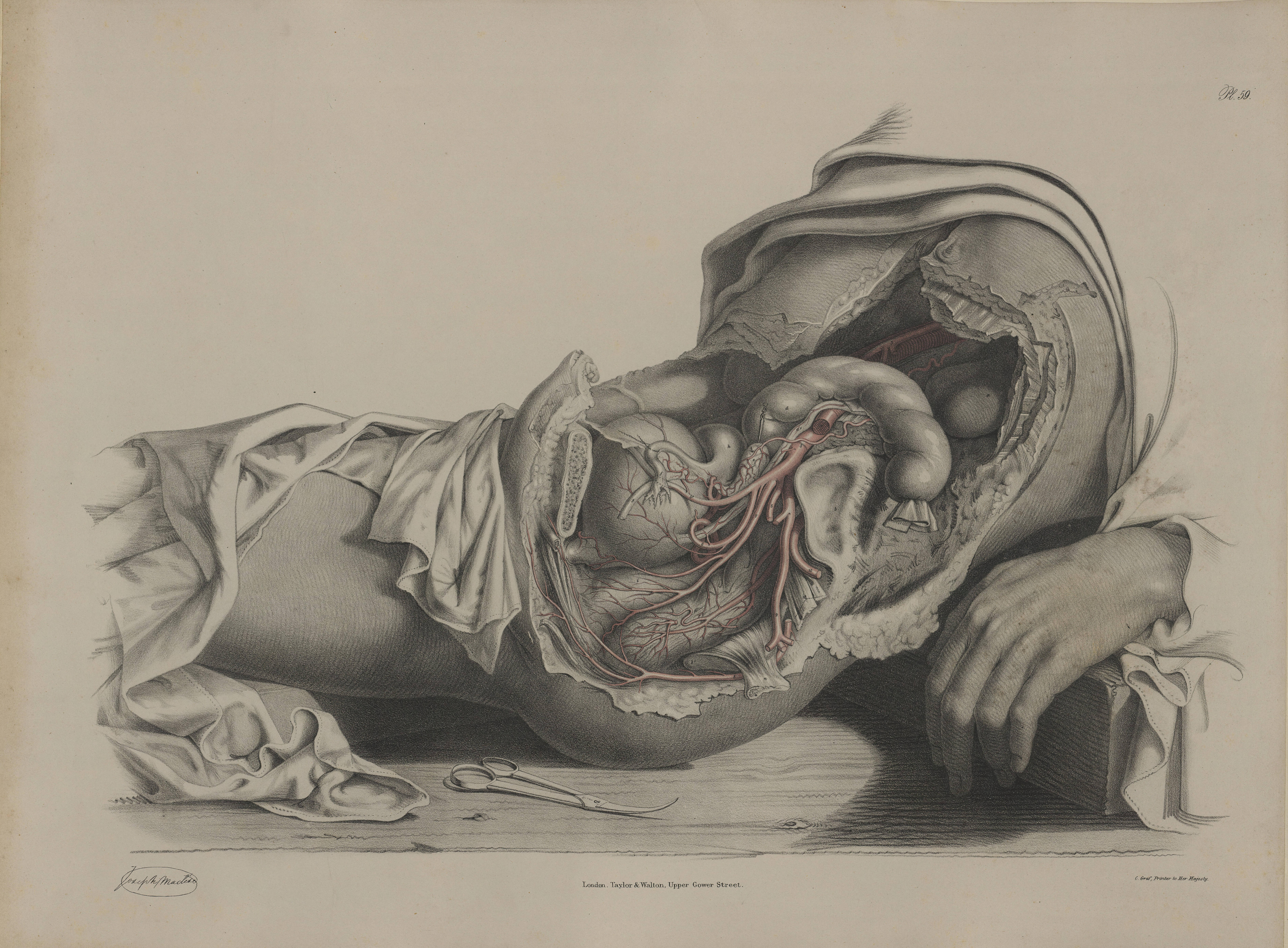 The anatomy of the arteries of the human body with its applications to pathology and operative surgery in lithographic drawings with practical commentaries